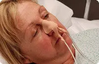 Dale Medical Nasogastric Tube Holder 1